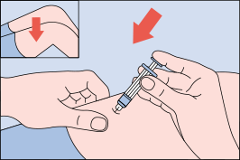 Figure K: Image of pinching skin to insert needle to inject Glucagon